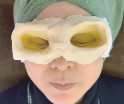 ネトラバスティ